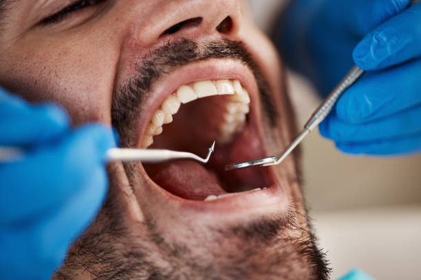Best Knocked-Out Tooth Emergency  in Worth, IL